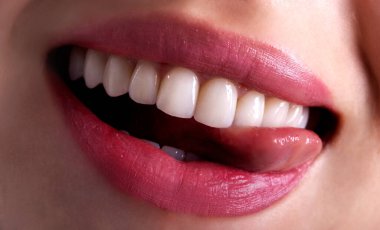 Mükemmel Yakın çekim seksi baştan çıkarıcı pembe dudaklı kadın diliyle gülümsüyor. Beyaz dişleri beyazlatan seramik taç takan genç bayan. Diş zirkon implantı yenileme ameliyatı