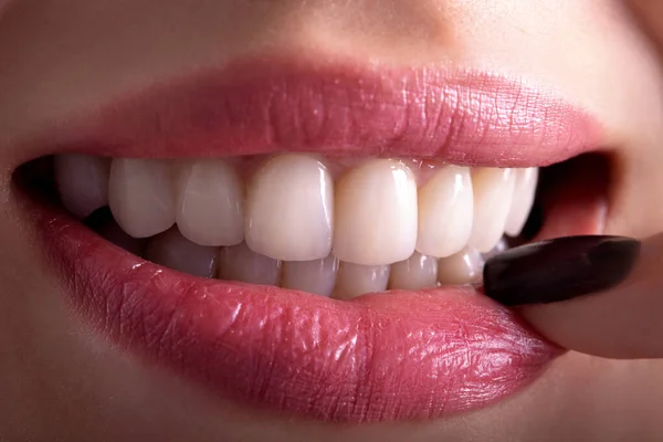 完璧な閉じる官能的な美しいセクシーな誘惑ピンクの唇の女性は舌で笑顔 白い歯漂白セラミッククラウン若い女性を白くします 歯科ジルコンインプラント修復手術 — ストック写真