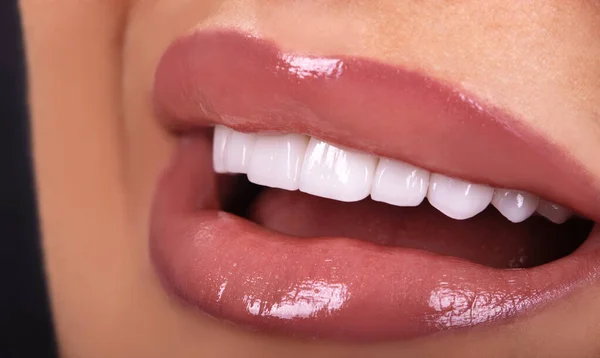 完璧な閉じる官能的な美しいセクシーな誘惑ピンクの唇の女性は舌で笑顔 白い歯漂白セラミッククラウン若い女性を白くします 歯科ジルコンインプラント修復手術 — ストック写真