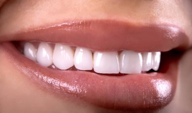 Seksi, baştan çıkarıcı, dolgun dudaklı kadın gülüşü. Beyaz güzel dişleri beyazlatan seramik taç takan genç bayan gülümsüyor. Diş zirkon implantları restorasyon cerrahisi moda konsepti