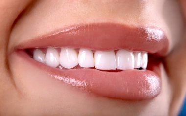 Seksi, baştan çıkarıcı, dolgun dudaklı kadın gülüşü. Beyaz güzel dişleri beyazlatan seramik taç takan genç bayan gülümsüyor. Diş zirkon implantları restorasyon cerrahisi moda konsepti