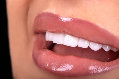 Seksi, baştan çıkarıcı, dolgun dudaklı kadın gülüşü. Beyaz güzel dişleri beyazlatan seramik taç takan genç bayan gülümsüyor. Diş zirkon implantları restorasyon cerrahisi moda konsepti