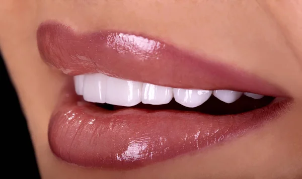 Perfekte Nahaufnahme Sinnlich Sexy Verführerisch Plump Lips Frau Lächeln Weiße — Stockfoto