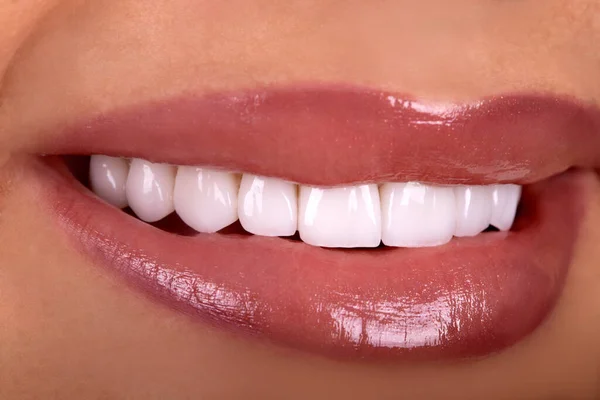 Perfect Close Sensual Sexy Seductive Plump Lips Woman Smile White — Stock Photo, Image