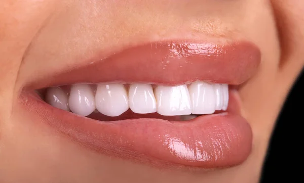 Perfect Close Sensueel Sexy Verleidelijk Mollig Lippen Vrouw Glimlach Witte — Stockfoto