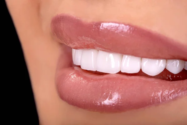 Perfect Close Sensuel Sexy Seductive Plump Lips Femme Sourire Blanc — Photo