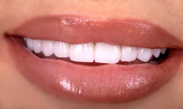 Perfect Close Sensueel Sexy Verleidelijk Mollig Lippen Vrouw Glimlach Witte — Stockfoto