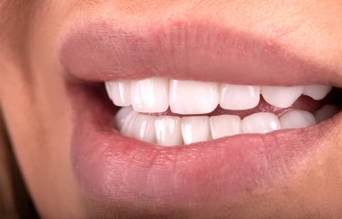 Seksi, baştan çıkarıcı, dolgun dudaklı kadın gülüşü. Beyaz güzel dişleri beyazlatan seramik taç takan genç bayan gülümsüyor. Diş zirkon implantları restorasyon cerrahisi moda konsepti