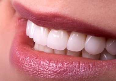 Seksi, baştan çıkarıcı, dolgun dudaklı kadın gülüşü. Beyaz güzel dişleri beyazlatan seramik taç takan genç bayan gülümsüyor. Diş zirkon implantları restorasyon cerrahisi moda konsepti