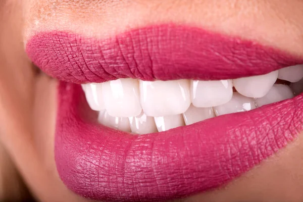 Perfect Close Up White beautiful Veneers Teeth bleaching crowns whitening young lady smiling, Sensual sexy Seductive plump Lips woman smile . Dental zircon implants restoration surgery. Fashion concept