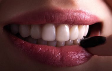Kusursuz Kapalı Beyaz Venedikliler dişleri beyazlatan genç bayan gülümseyen şehvetli, baştan çıkarıcı, tombul dudaklı kadın gülüşü. Diş zirkon implantı yenileme ameliyatı. Moda konsepti