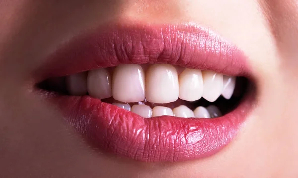 Perfect Close Up White beautiful Veneers Teeth bleaching crowns whitening young lady smiling, Sensual sexy Seductive plump Lips woman smile. Dental zircon implants restoration surgery. Fashion concept
