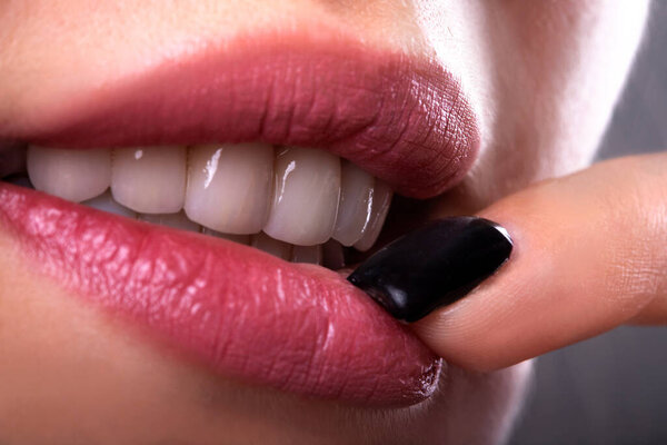 Perfect Close Up Белые красивые виниры Отбеливание зубов коронки отбеливание молодая леди улыбаясь, чувственный сексуальный соблазнительный пухлые губы женщина улыбка. Операция по восстановлению зубных цирконовых имплантов. Концепция моды