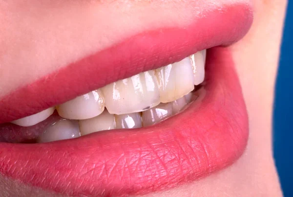 Κοντινό Πλάνο Βρώμικο Στραβό Κίτρινο Δόντια Νεαρή Κοπέλα Χαμογελά Αισθησιακό Royalty Free Εικόνες Αρχείου