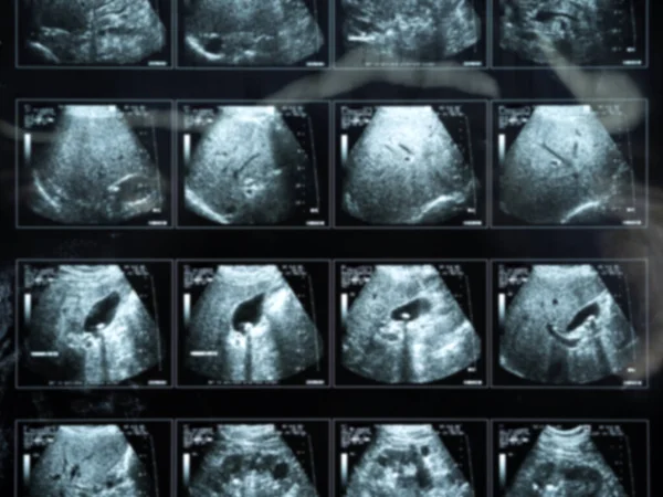 Blurred background of a set of result medical examination ultrasound study.
