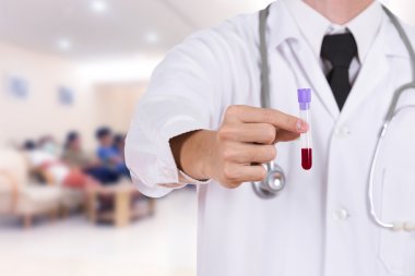 bir tıbbi test cam kan ile kapatmak