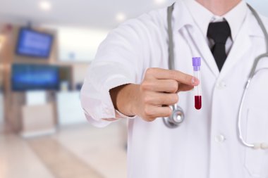 bir tıbbi test cam kan ile kapatmak