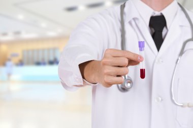 bir tıbbi test cam kan ile kapatmak