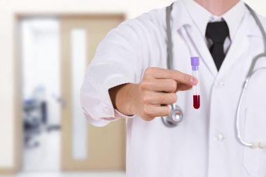 bir tıbbi test cam kan ile kapatmak