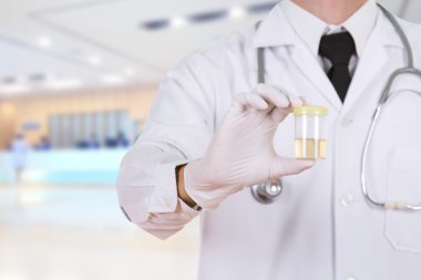 idrar örneği bir şişe tutan hastanede doktor el