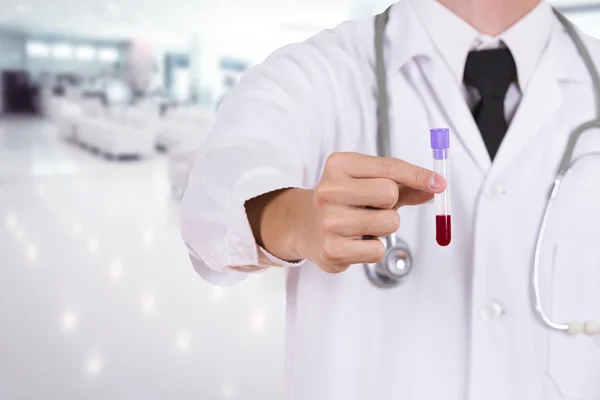 Fermer un verre de test médical avec du sang — Photo