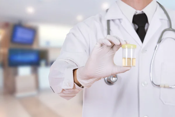 Main du médecin tenant une bouteille d'échantillon d'urine à l'hôpital — Photo