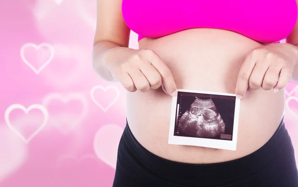 Mulheres grávidas mãos segurando ultra-som foto no backrgrou coração — Fotografia de Stock