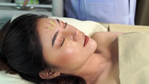 Jeune Femme Traitement Acupuncture Sur Visage — Video