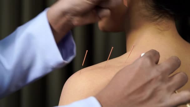 Jonge Vrouw Ondergaat Acupunctuur Behandeling Schouder — Stockvideo