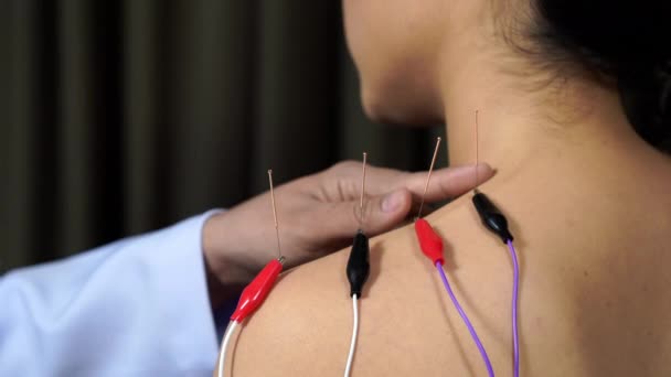Genç Bir Kadın Omzunda Elektrik Uyarıcısıyla Akupunktur Tedavisi Görüyor — Stok video