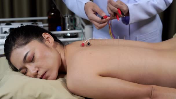 Giovane Donna Sottoposta Trattamento Agopuntura Con Stimolatore Elettrico Sulla Schiena — Video Stock