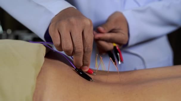 Close Vrouw Ondergaan Acupunctuur Behandeling Met Elektrische Stimulator Rug — Stockvideo