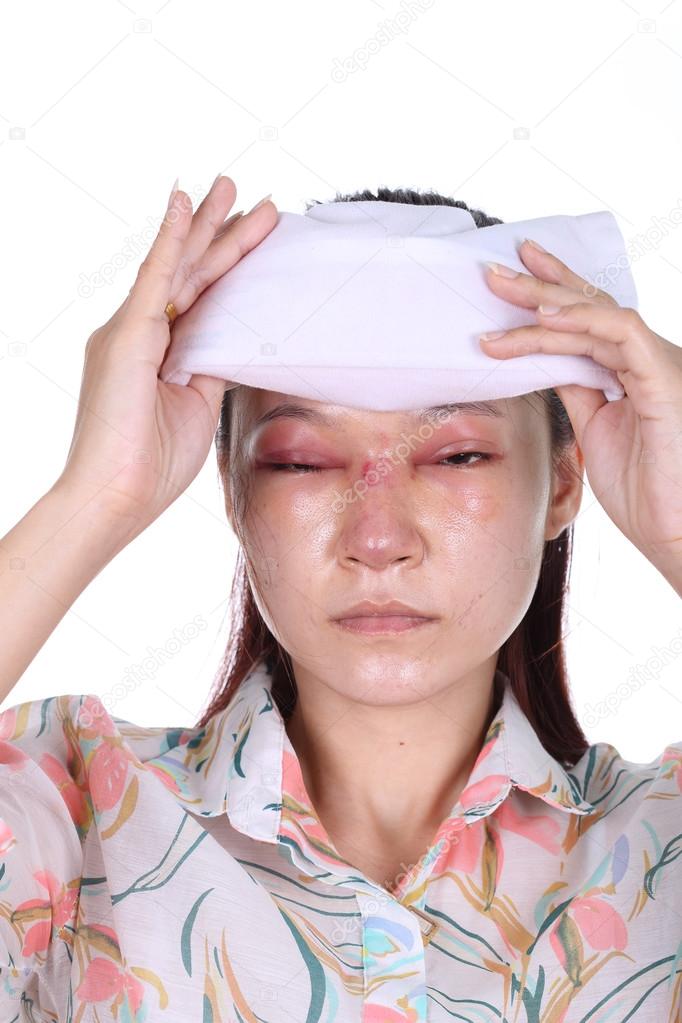 Woman holds an ice pack after nose job 