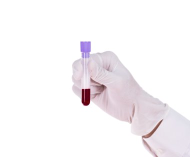Kan ile el ele tutuşan test tüpü