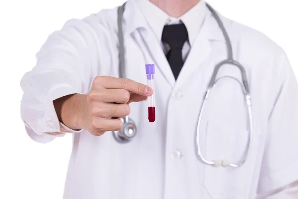 Close up a medical test glass with blood — Stock Photo, Image