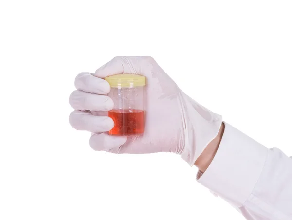 Doctor's hand in handschoenen met een transparante container met de — Stockfoto
