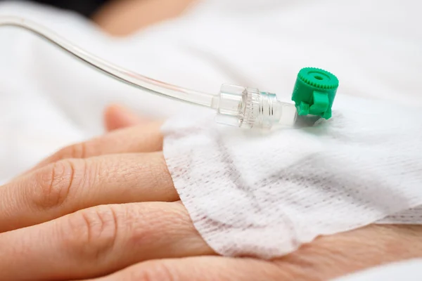 Close up of a iv drip in patient's hand — Stock Photo, Image