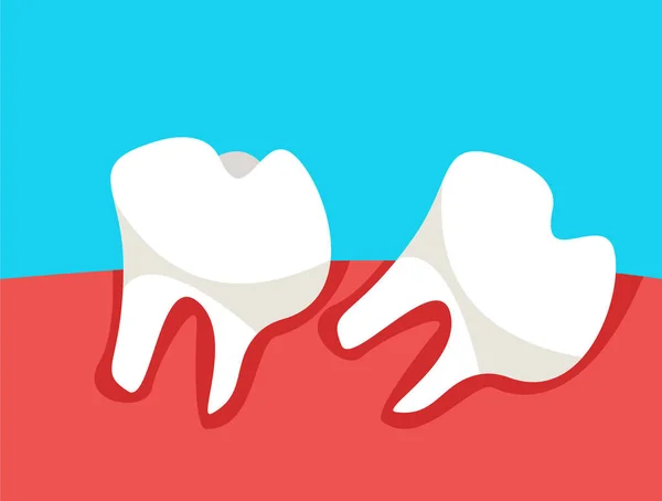 Cavidade Oral Com Dentes Que Crescem Torquidos Ilustração Vetorial Plana — Vetor de Stock