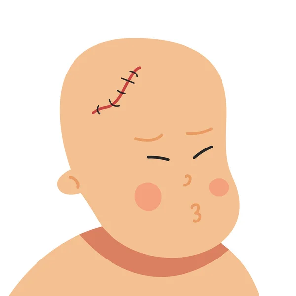 Ein Kind mit einer Narbe am Kopf nach einer Operation. Schmerzen durch Narbenbildung. Medizinische Behandlung von Kindern. Stockvektor