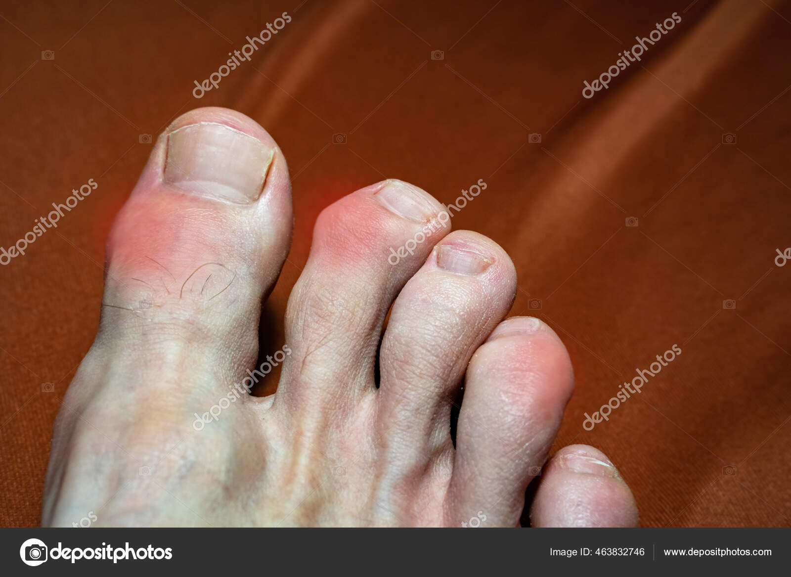fájdalmas lábujjak