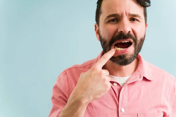 Devo Togliermi Dente Giovane Con Mal Denti Che Dice Dentista — Foto Stock