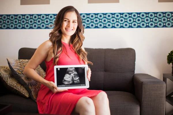 Femme qui attend un bébé — Photo