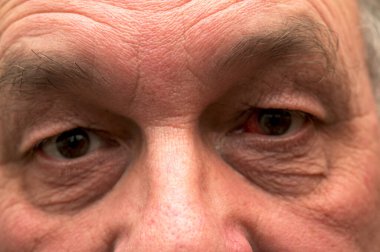 Göz kanaması. İnsan gözlerini görünür kırışıklıklar ve yoğun bakışlarla kapat. Yaş kavramı, yaşam deneyimi, duygusal derinlik ve rötuş yapmadan gerçekçi bir portre..