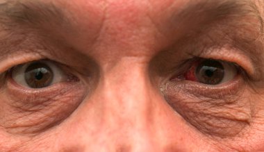 Göz kanaması. İnsan gözlerini görünür kırışıklıklar ve yoğun bakışlarla kapat. Yaş kavramı, yaşam deneyimi, duygusal derinlik ve rötuş yapmadan gerçekçi bir portre..