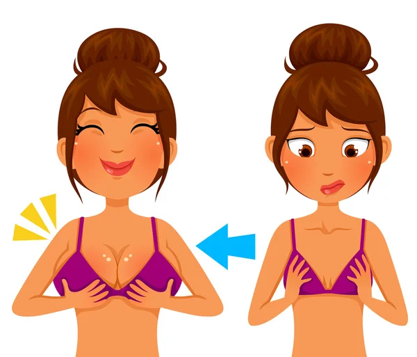 Breast augmentation - before and after — Stock Vector