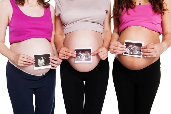 Close up of group pregnant women holding ultrasound scan on her tummy — Stock Photo, Image