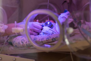 Yeni doğan bebeği kuvözde muayene eden kadın doktor. Kadın ellerini steteskopla kapat..