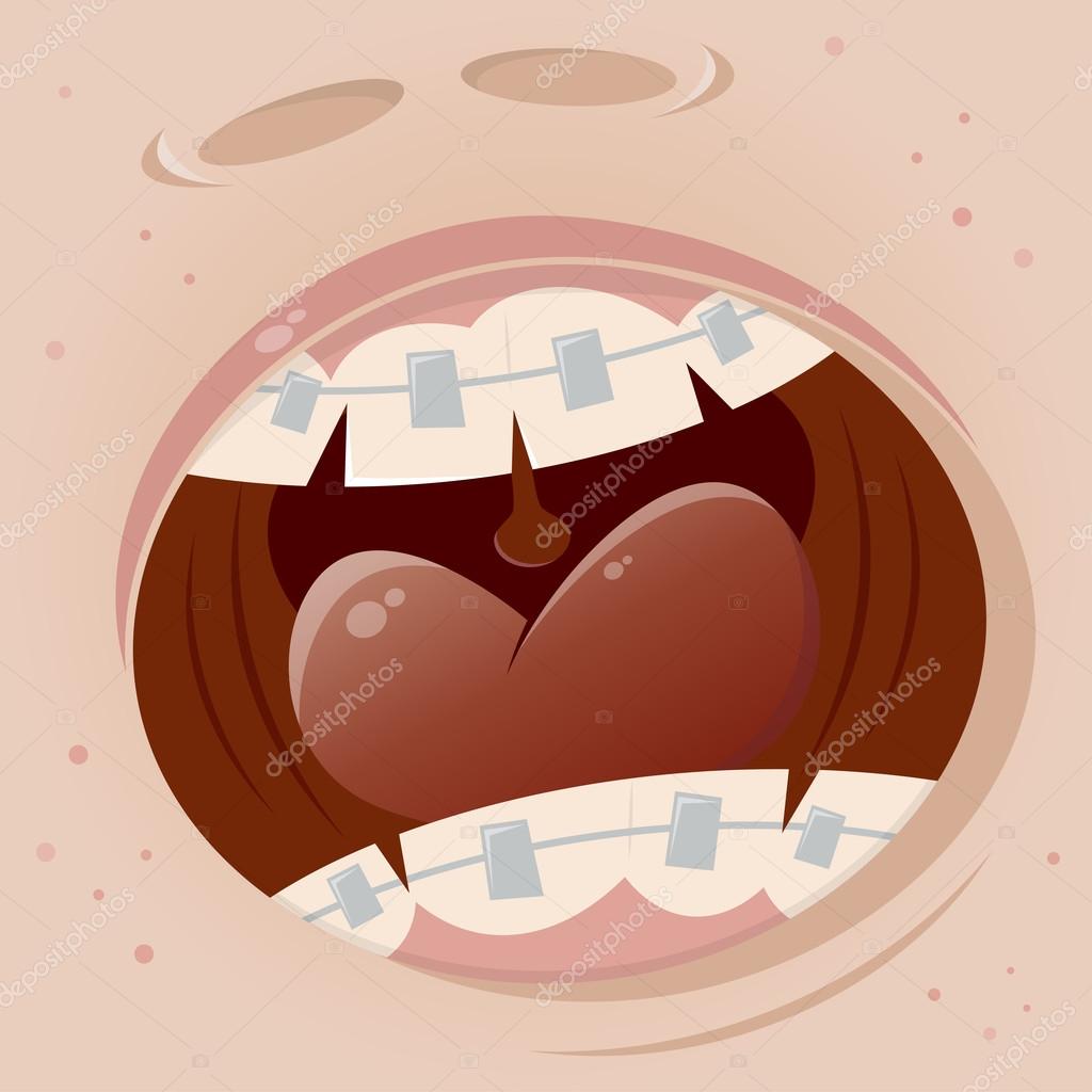 Clipart funny mouths Braces mouth cartoon funny clipart — Stock Vector © shockfactor.de