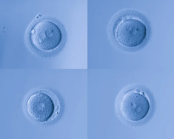 Mänskliga celler ägg — Stockfoto