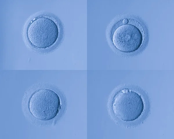 Human cells egg — Stock Photo, Image